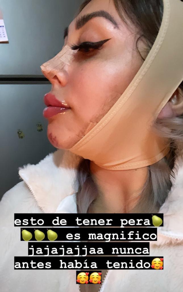 Cambio total: Naya Fácil impacta por retoques en su rostro