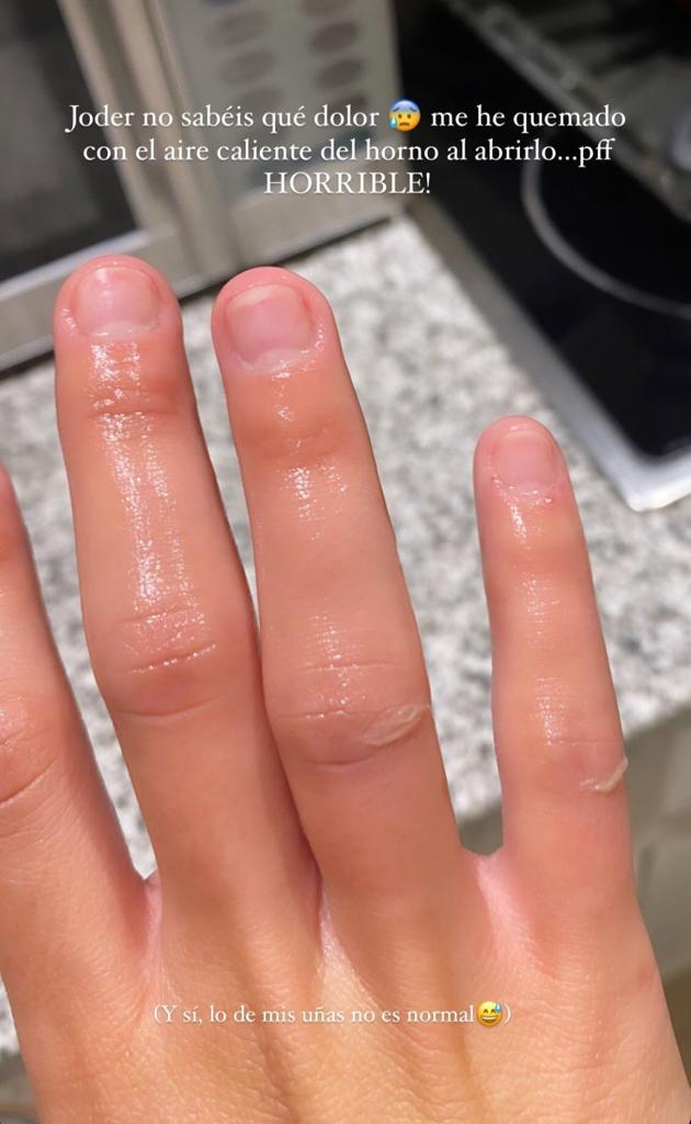 Oriana Marzoli sufre doloroso accidente casero