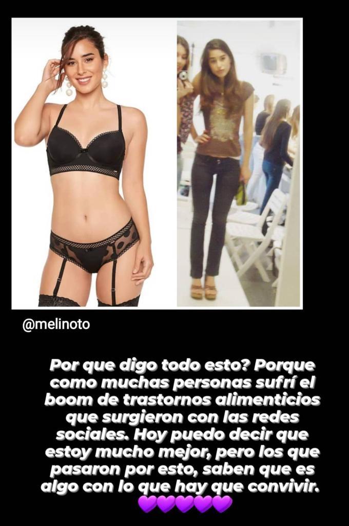 “Lo más real”: Polola de Pangal Andrade enseña su rostro sin filtro