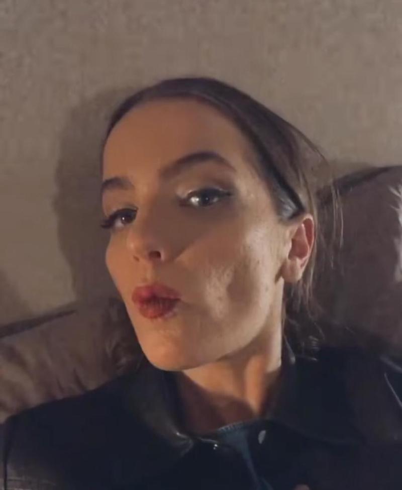 Millaray Viera pide respeto por las pieles imperfectas