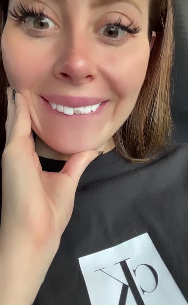 Ignacia Michelson enseña cómo era su rostro naturalmente