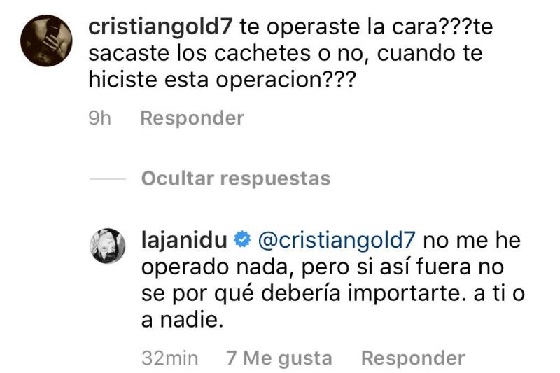 “¿Te operaste la cara?”: Jani Dueñas reacciona a pregunta de seguidor