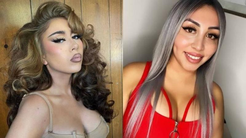 Cambio total: Naya Fácil impacta por retoques en su rostro