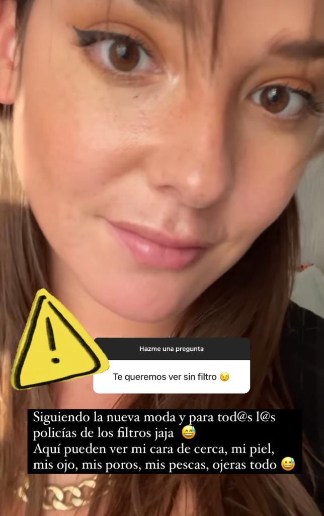 Kel Calderón muestra su rostro sin filtros y revela drama capilar