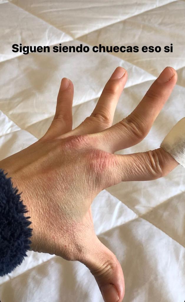 Ángela Duarte sorprende al mostrar sus particulares manos