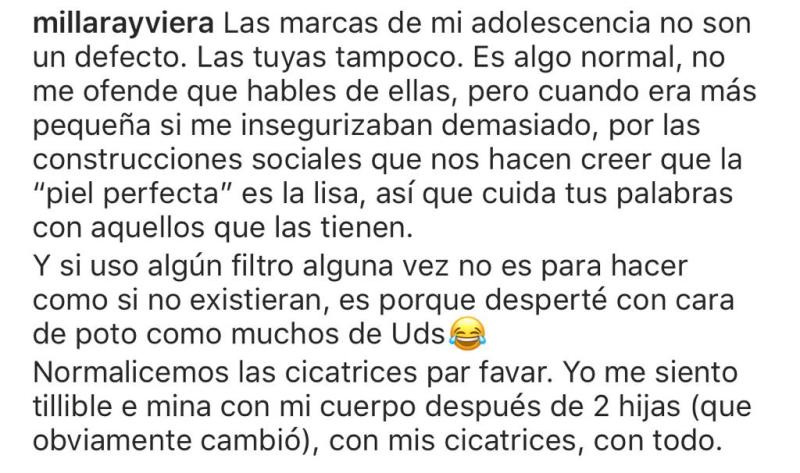 Millaray Viera pide respeto por las pieles imperfectas