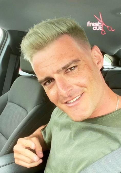 Ignacio Casale se somete a radical cambio de look