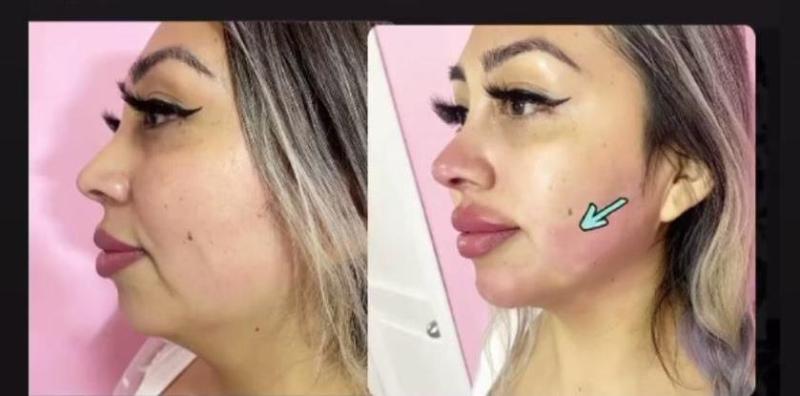 Cambio total: Naya Fácil impacta por retoques en su rostro