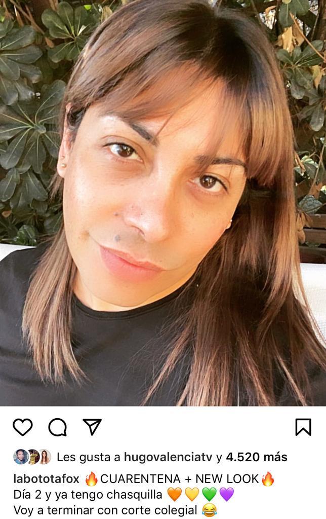 Botota Fox es comparada con Carmen Gloria Arroyo por foto