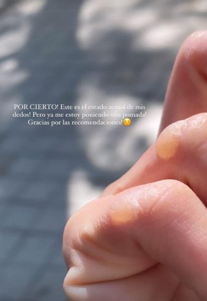 Oriana Marzoli sufre doloroso accidente casero