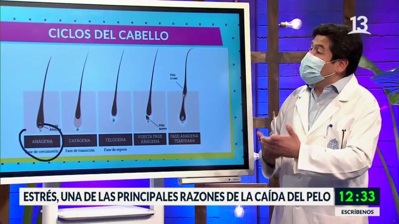 caída del pelo