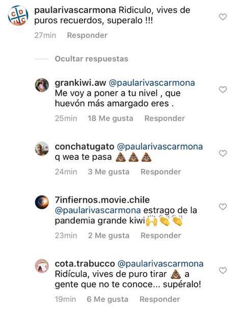 “Ridículo…supéralo”: Kiwi responde a duro ataque por sus fotos