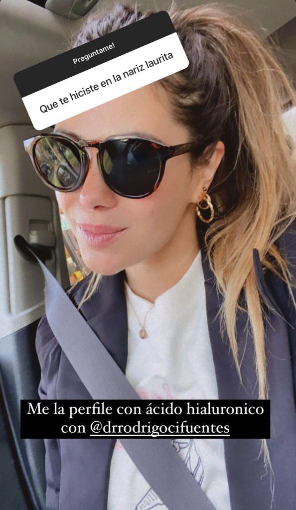 Laura Prieto confiesa intervención en su rostro