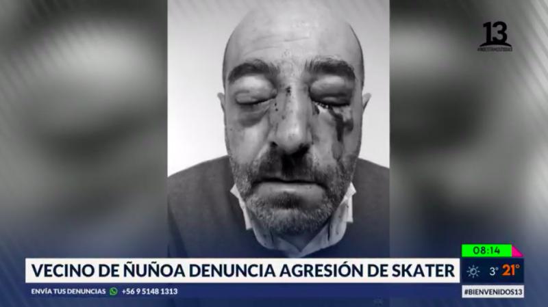 Vecino de Ñuñoa denuncia agresión de skater