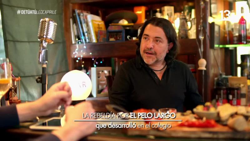 Leo Caprile habló sobre su experiencia con la alopecia