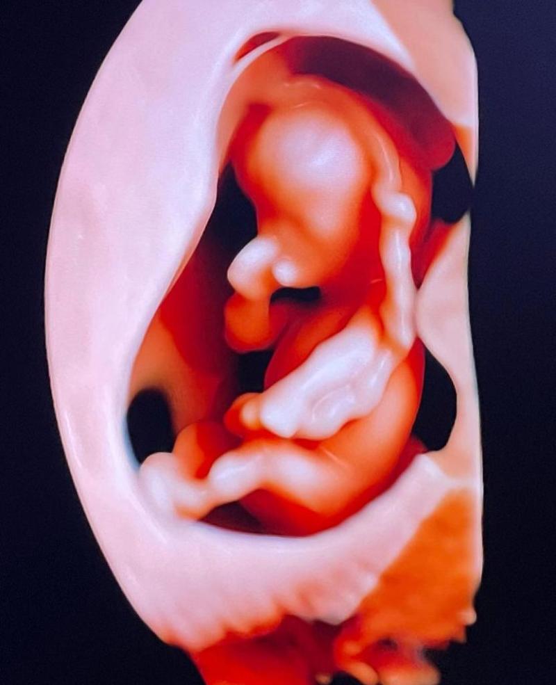 Manuel de Tezanos confirma embarazo de su novia