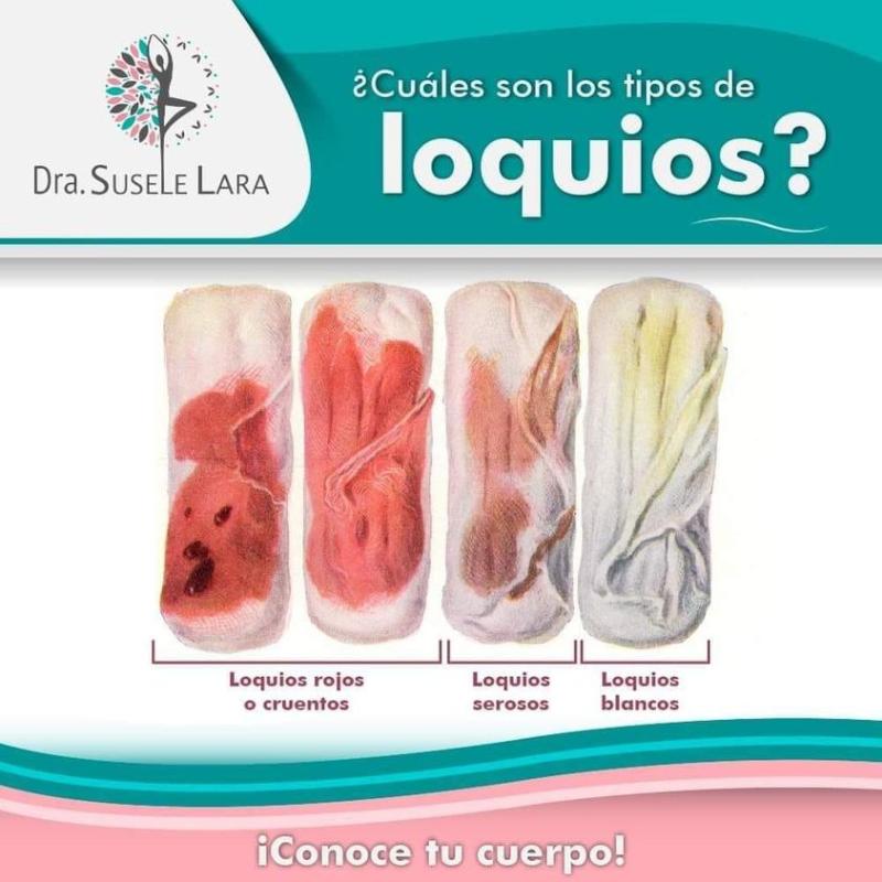 Tipos de loquios