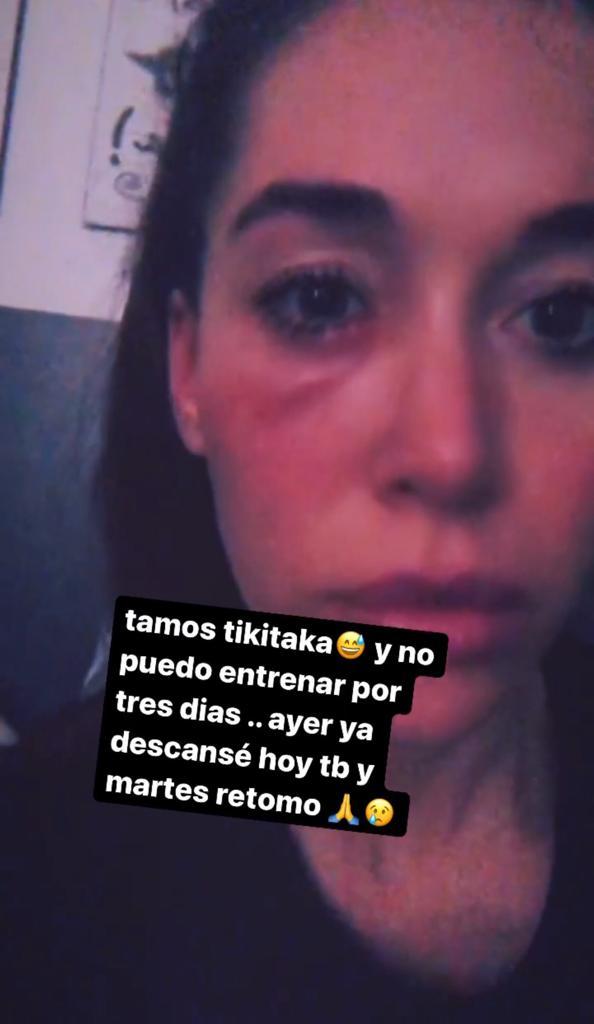 Vale Roth preocupa por rara erupción en su rostro