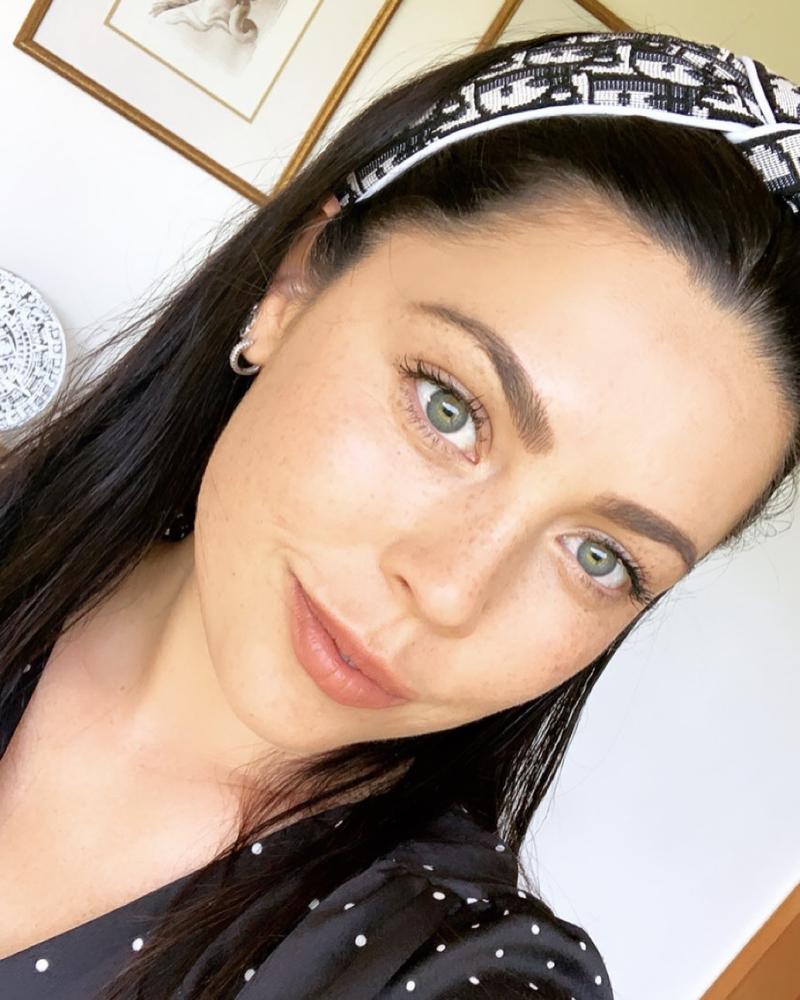 Daniela Aránguiz muestra su boca tras retoque