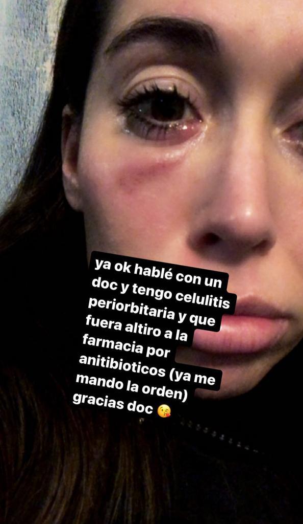 Vale Roth preocupa por rara erupción en su rostro