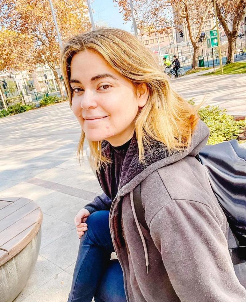 Carmen Tuitera exhibe las consecuencias faciales de tratamiento