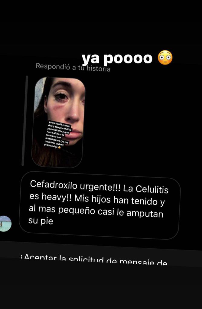 Vale Roth preocupa por rara erupción en su rostro