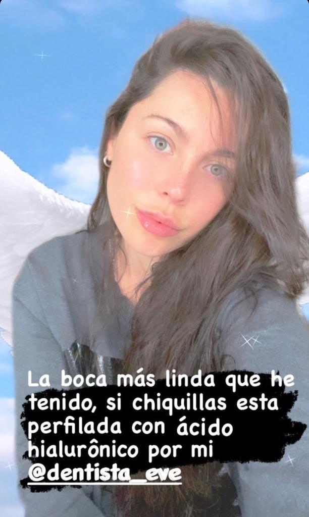 Daniela Aránguiz muestra su boca tras retoque