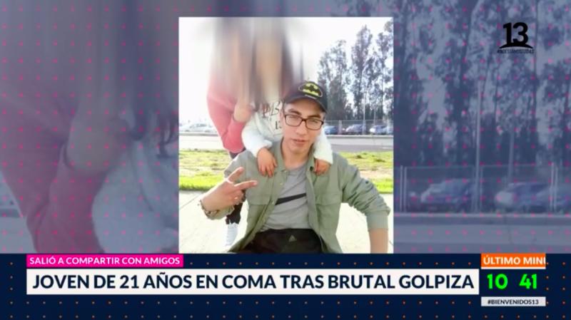 Joven de 21 años en coma tras brutal golpiza
