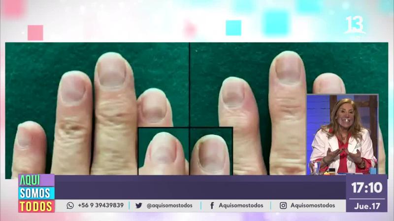 Aquí Somos Todos / Capítulo 304