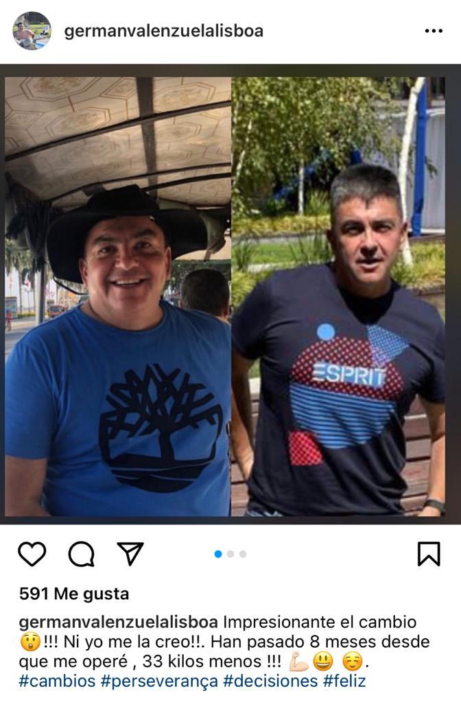 El impactante cambio físico del ex notero Germán Valenzuela