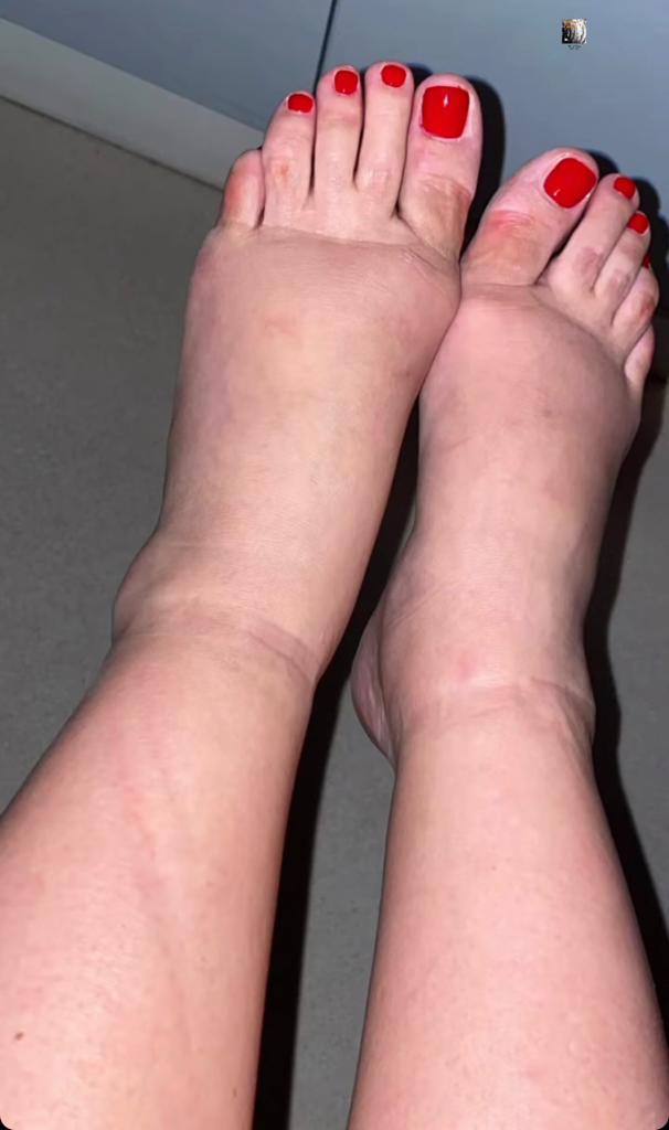 Pampita muestra los efectos del embarazo en sus pies