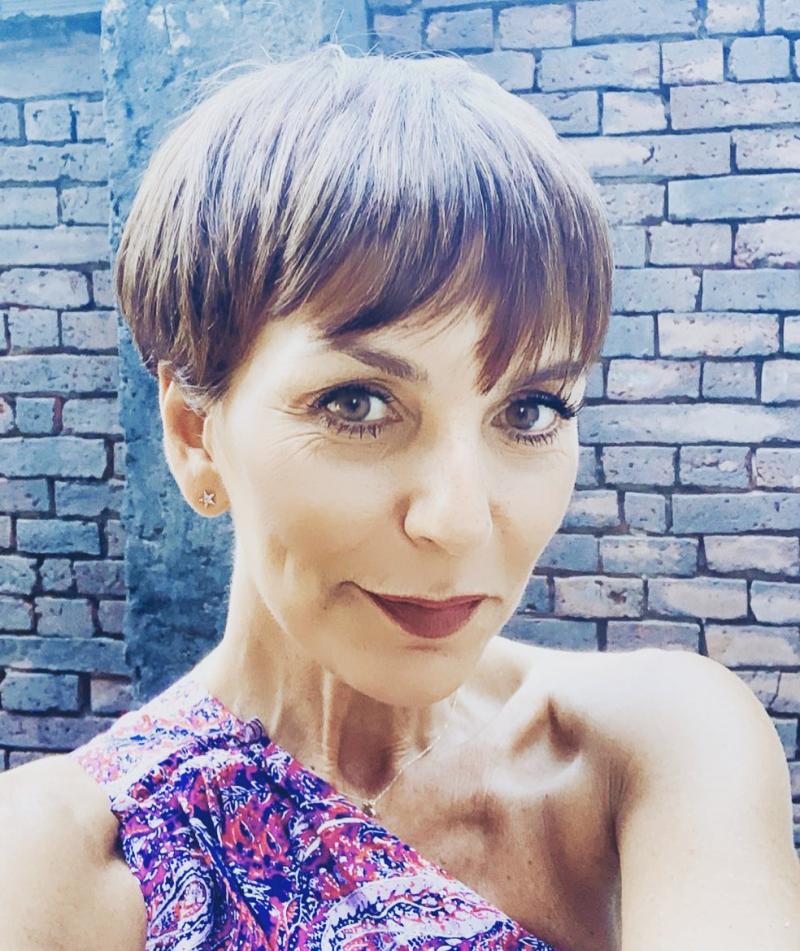 Fran García-Huidobro revela que deberá someterse a una nueva cirugía