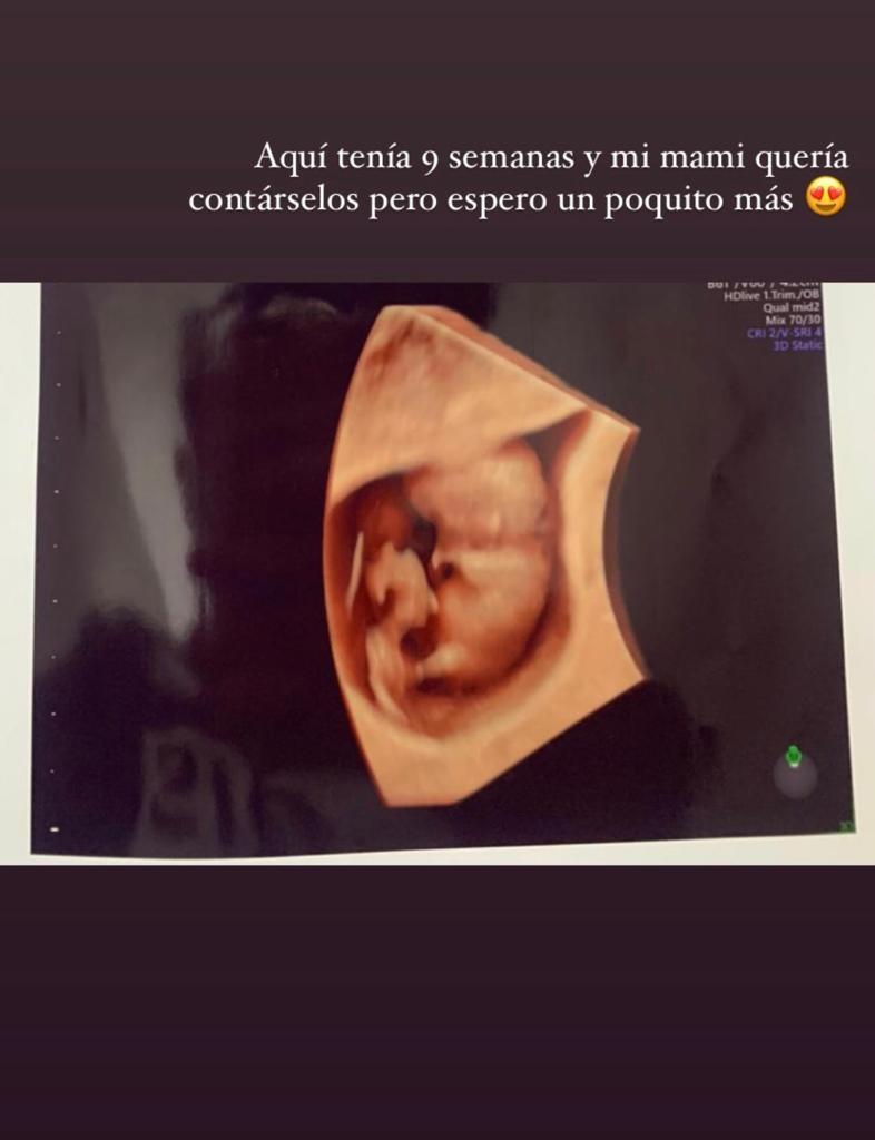 Sandy Boquita anuncia embarazo con foto familiar