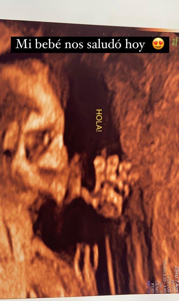 Sandy Boquita impacta al compartir especial ecografía