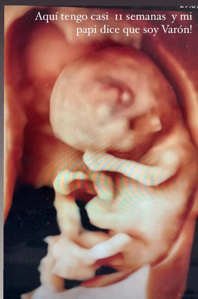 Sandy Boquita anuncia embarazo con foto familiar