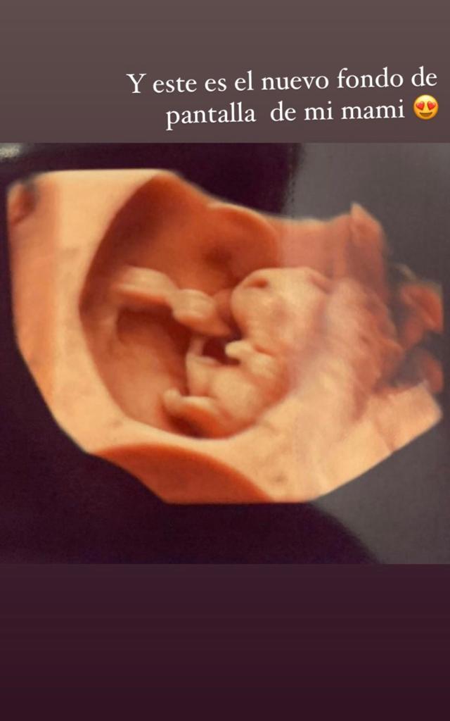 Sandy Boquita anuncia embarazo con foto familiar