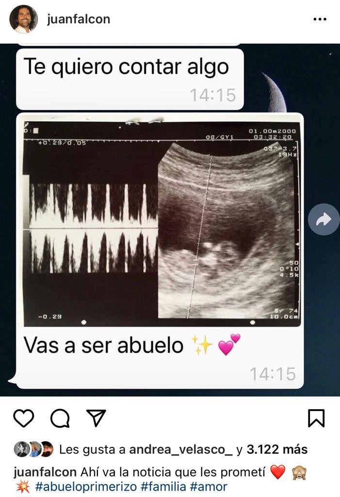 Juan Falcón anuncia con ecografía que será abuelo