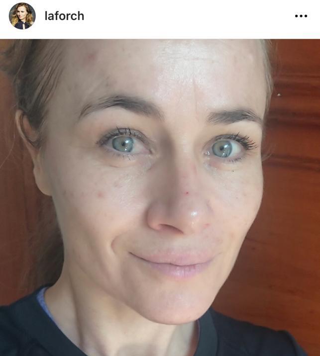 “Así soy”: Amaya Forch muestra las marcas de su rostro