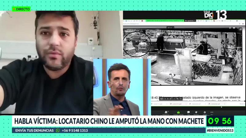 Hombre que perdió su mano por ataque en mall chino: “El tipo tiene que pagar”