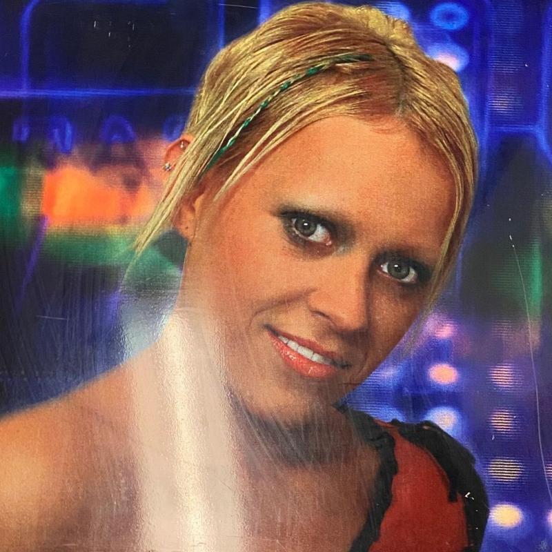 Monik perdió todo su pelo por enfermedad autoinmune