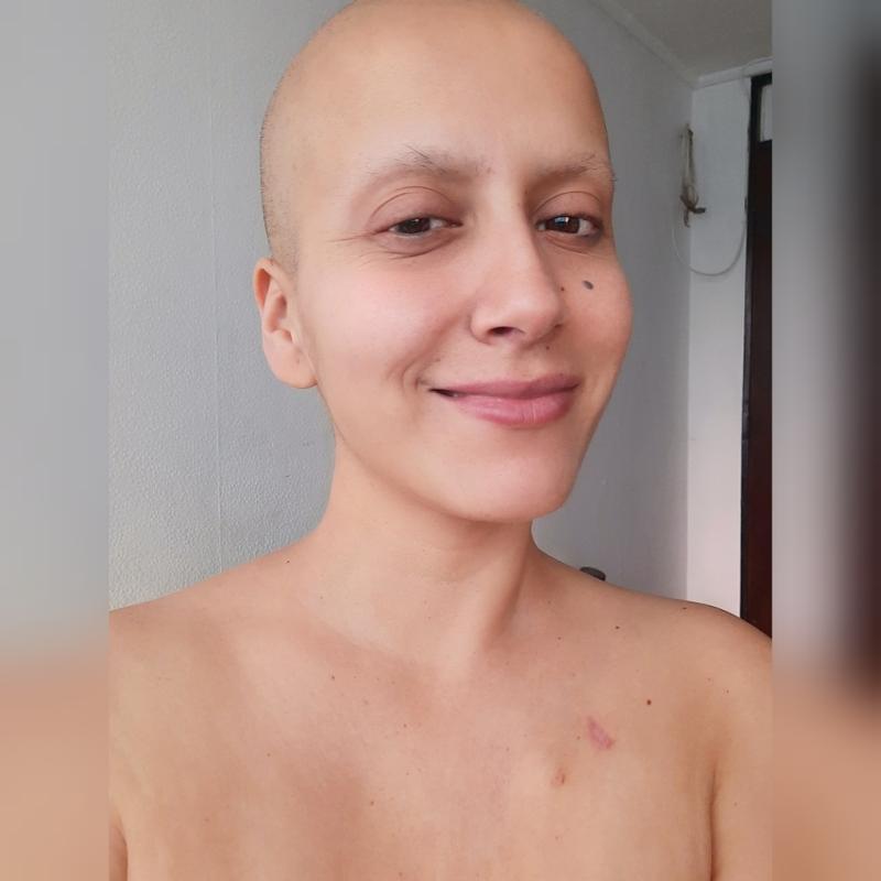 Mila Correa actualiza su estado de salud a un año del cáncer