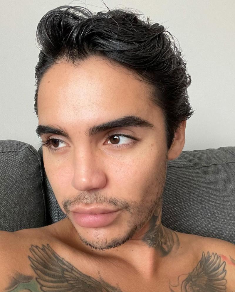 Leo Méndez Jr. se operó la nariz luego de sufrir golpiza