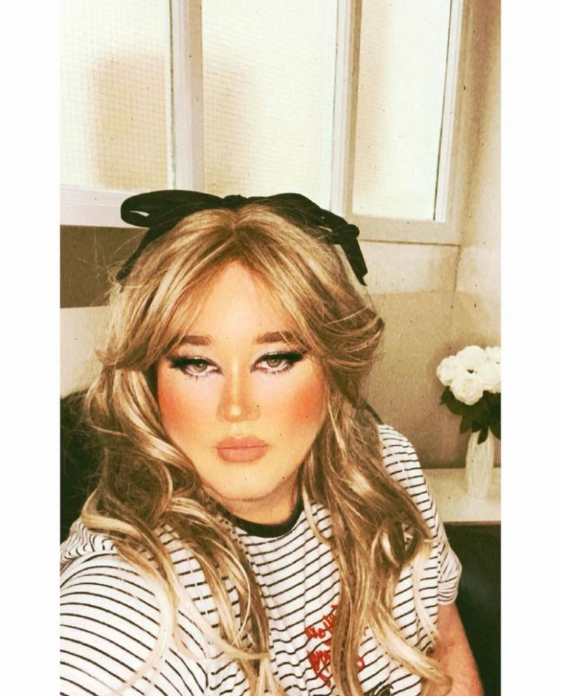 “Tiempo para volver”: Nicolás Yunge reaparece con nuevo look