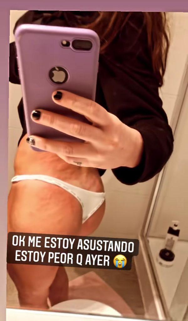 Vale Roth impacta al mostrar feroz reacción alérgica