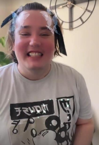 “Tiempo para volver”: Nicolás Yunge reaparece con nuevo look