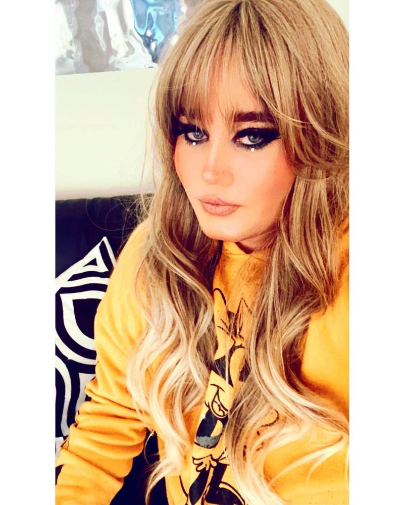 Comparan a Nicolás Yunge con Adele por nuevas fotos