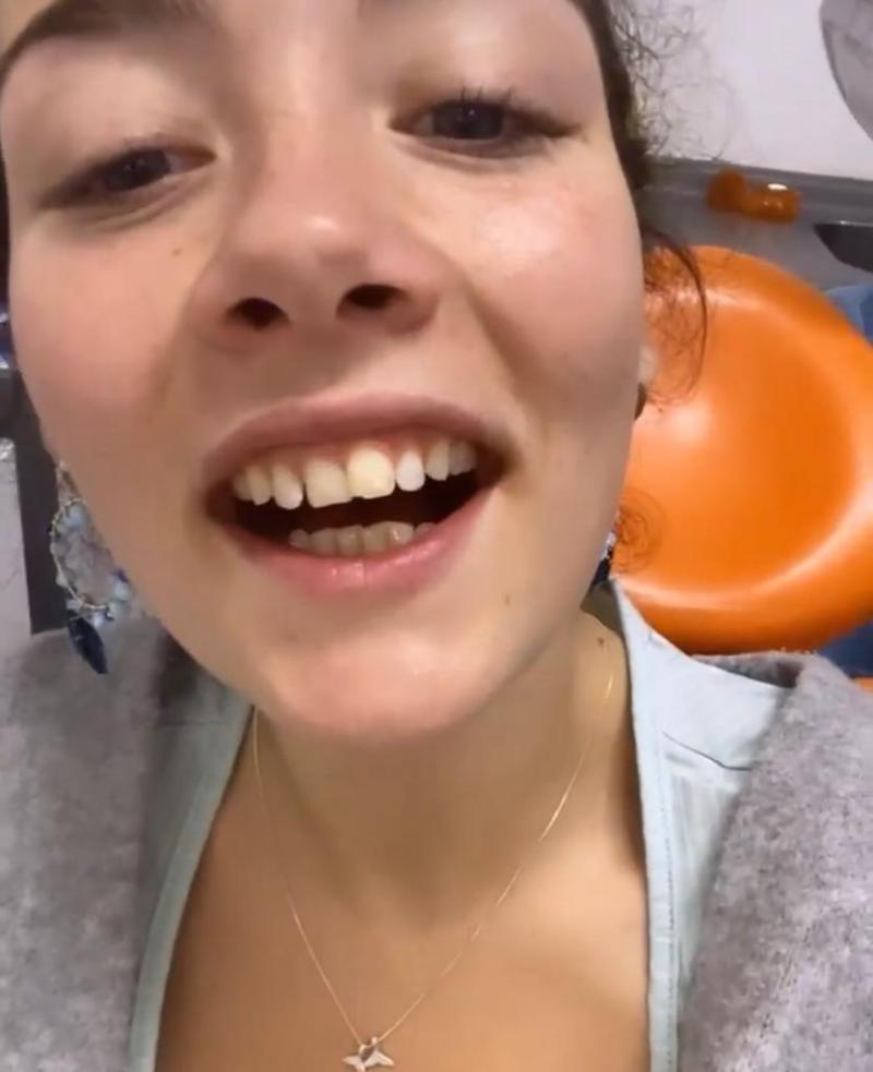 “Me rompí…”: Cota Castelblanco pierde pedazo de diente