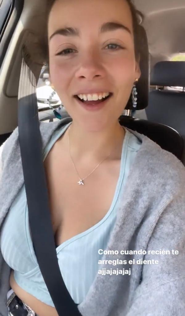 “Me rompí…”: Cota Castelblanco pierde pedazo de diente