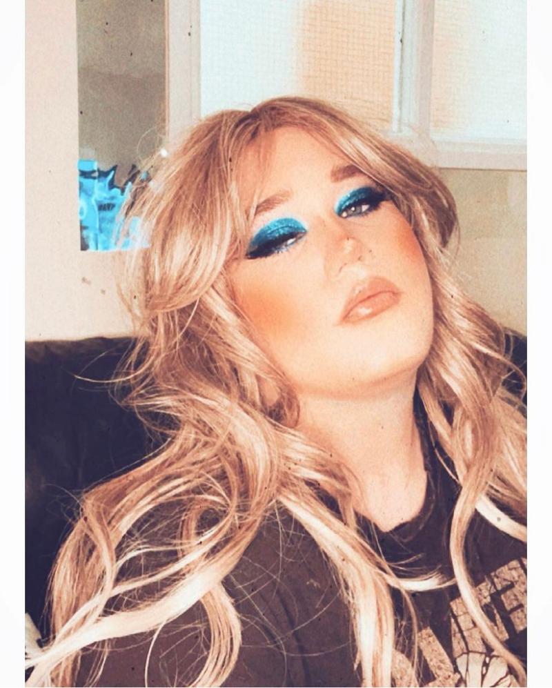 Comparan a Nicolás Yunge con Adele por nuevas fotos