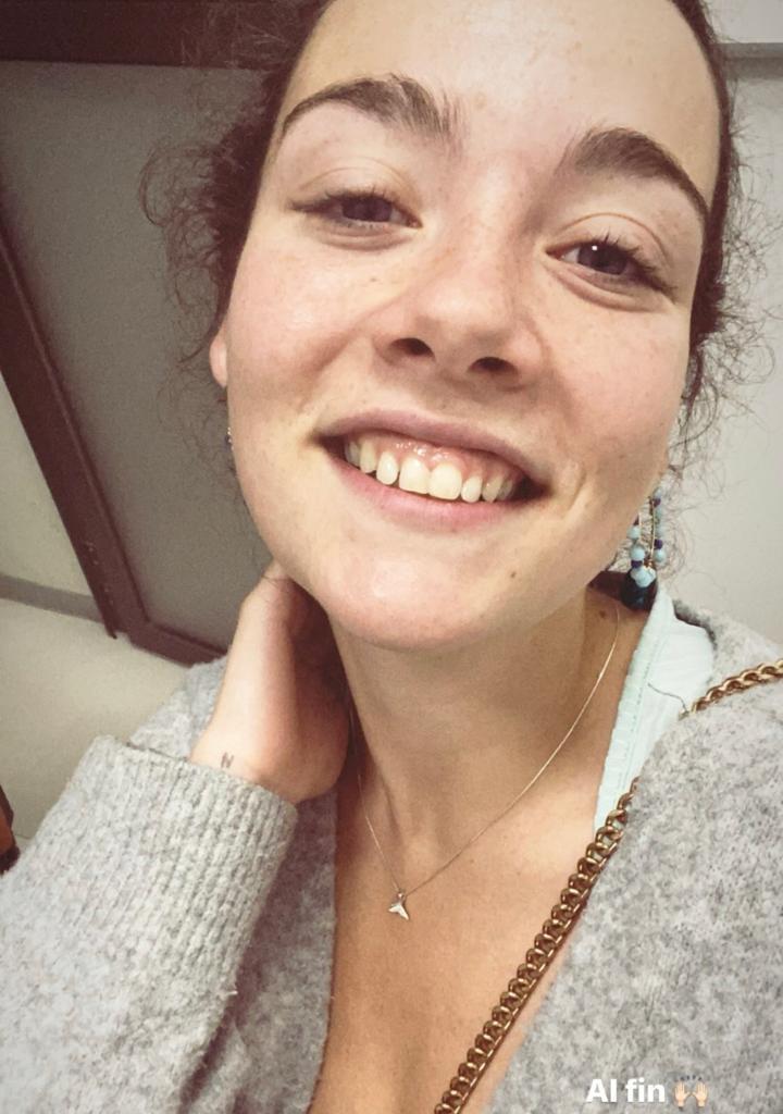 “Me rompí…”: Cota Castelblanco pierde pedazo de diente